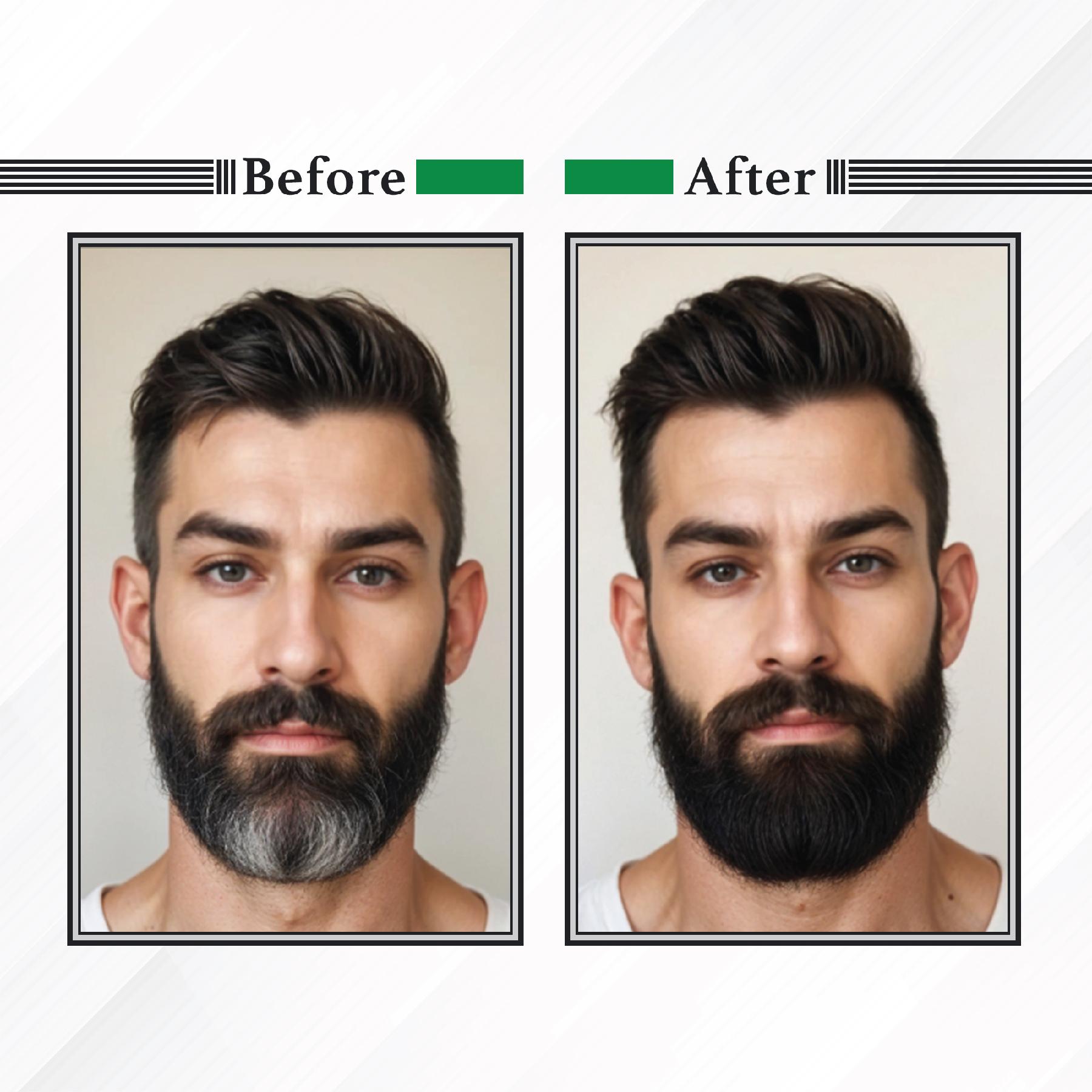 Nisha Beard Colour For Men (40GM) - Original Black, No Stain & Quick Color In 10 Minute, Complete Grey Coverage, Ammonia Free, Paraben Free (1 Pack) image 5