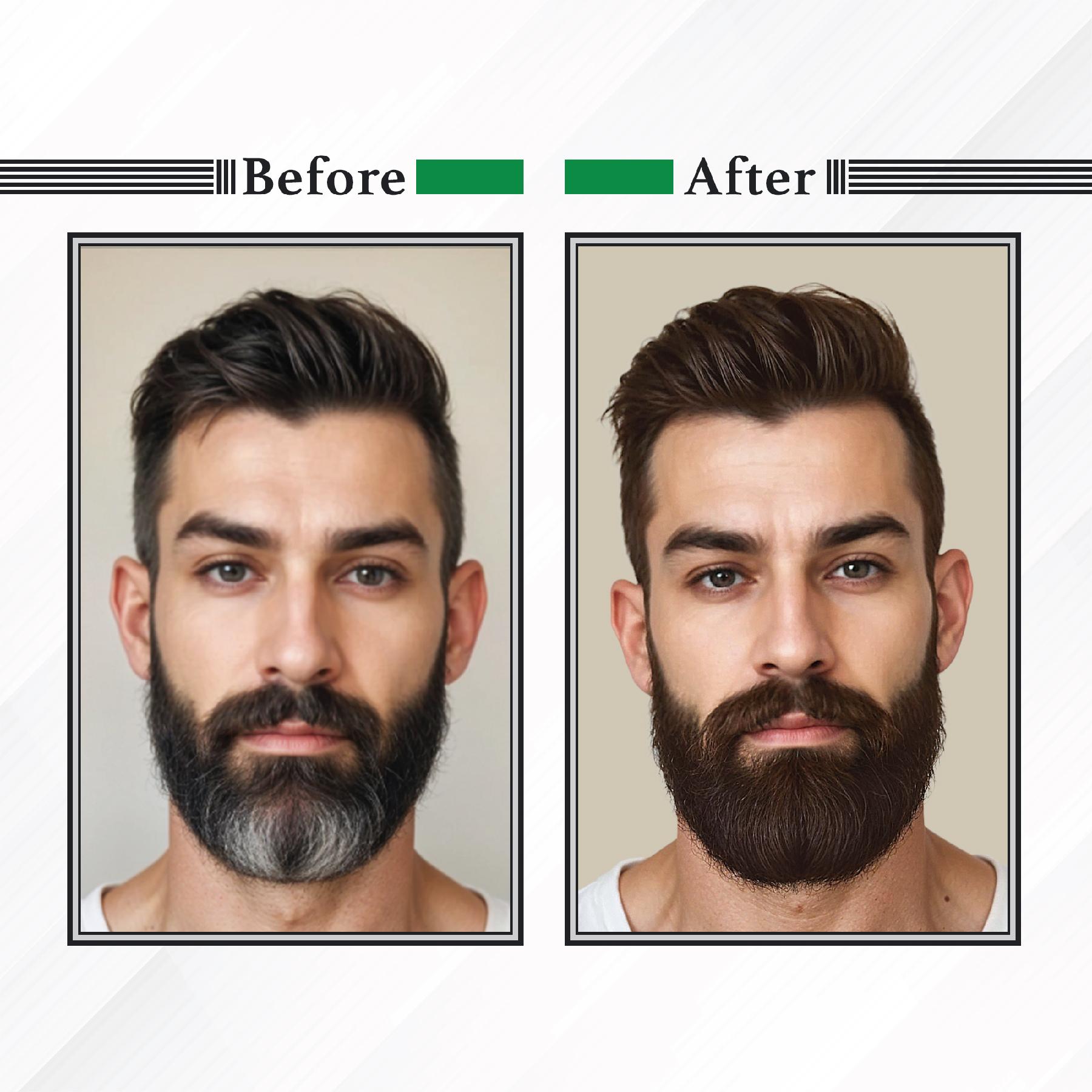 Nisha Beard Colour For Men (40GM) - Dark Brown, No Stain & Quick Color In 10 Minute, Complete Grey Coverage, Ammonia Free, Paraben Free (1 Pack) image 5