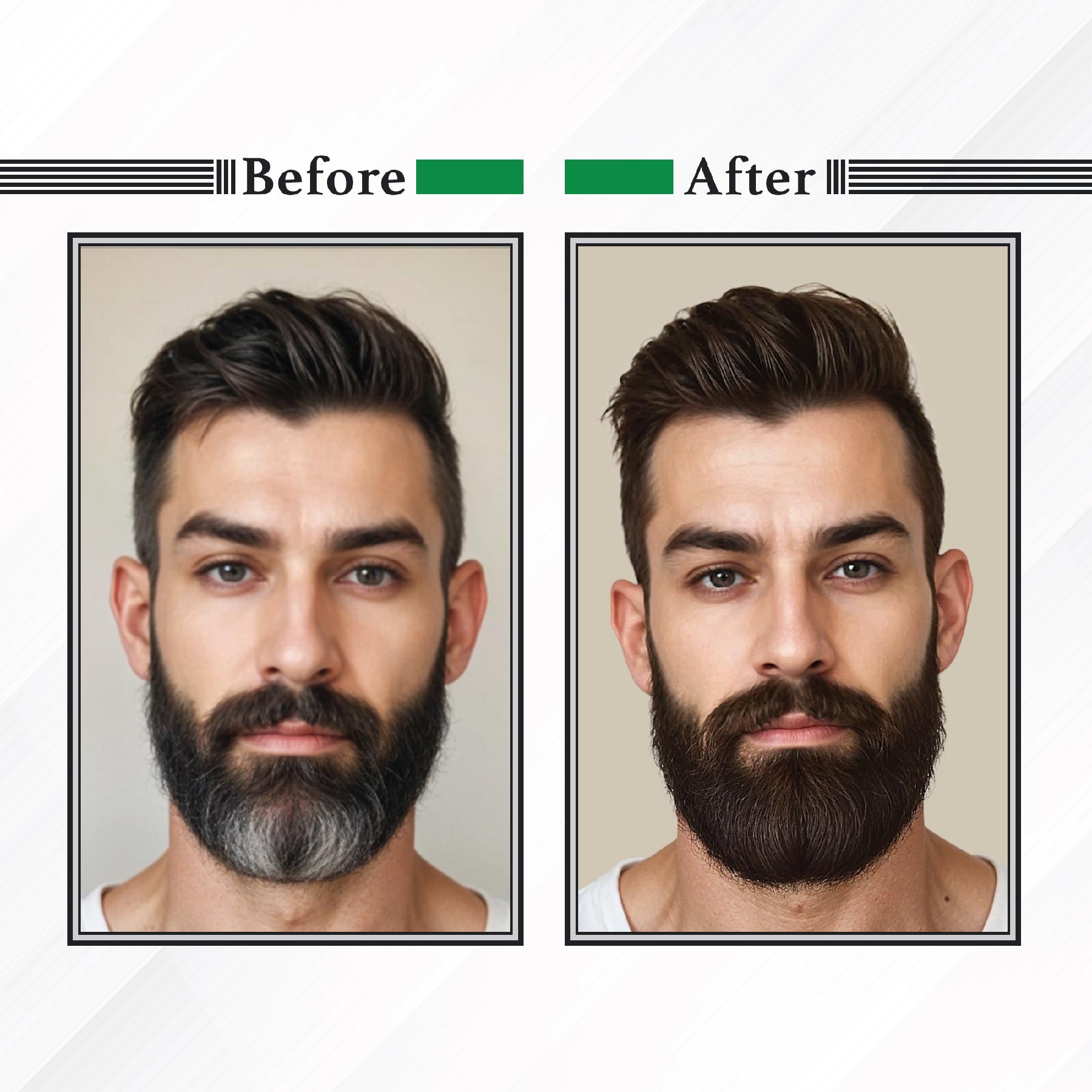 Nisha Beard Colour For Men (40GM) - Brown Black, No Stain & Quick Color In 10 Minute, Complete Grey Coverage, Ammonia Free, Paraben Free (1 Pack) image 5